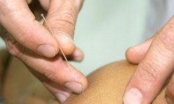 Suspendisse arcu nisl